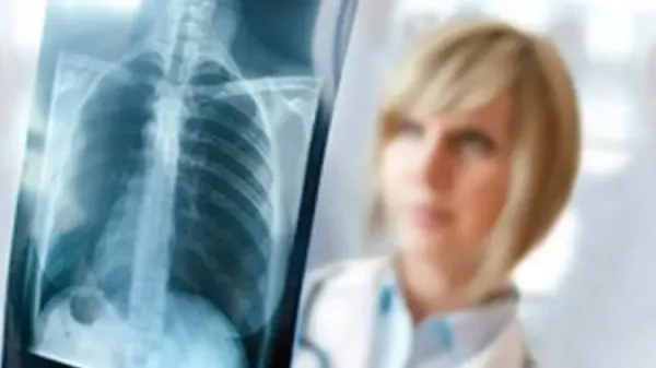 Deri kanseri ve genetik faktörler arasındaki ilişki nedir?